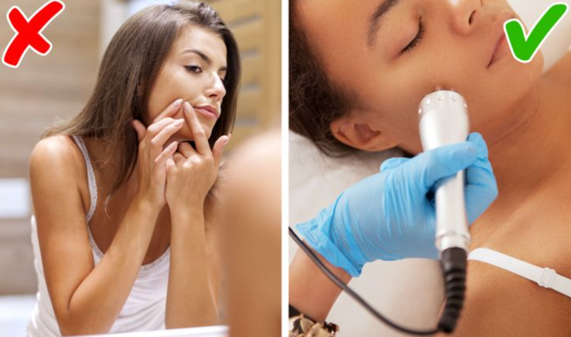 Không nên tự nặn mụn (Ảnh: BrightSide) Không nên tự nặn mụn (Ảnh: BrightSide)