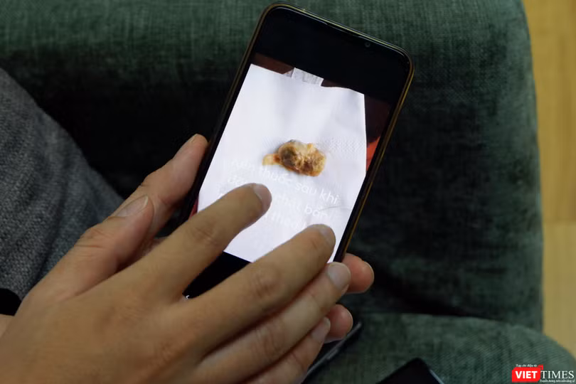 Viên kén âm đạo được quảng cáo tràn lan trên mạng có tác dụng trị hàng loaht bệnh khó nói của chị em phụ nữ (Ảnh: Minh Thúy) 