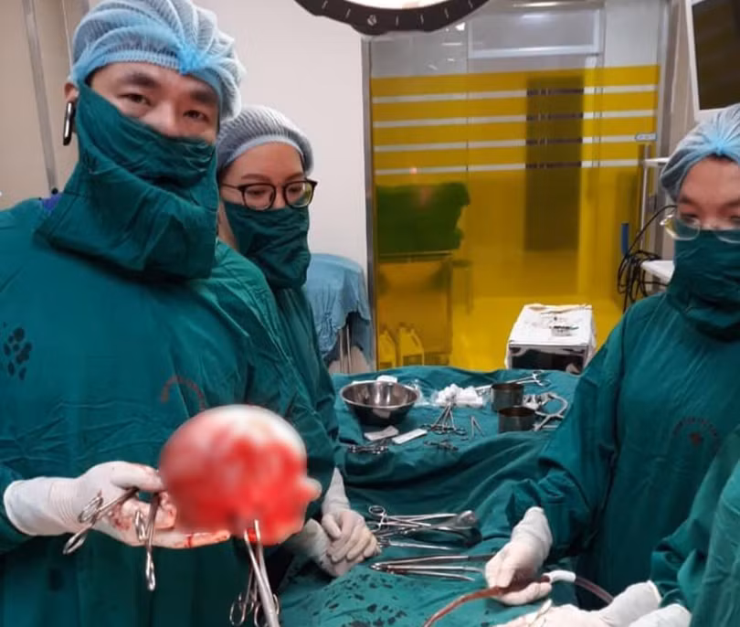 Bác sĩ cắt bỏ khối u xơ (Ảnh: BVCC) 