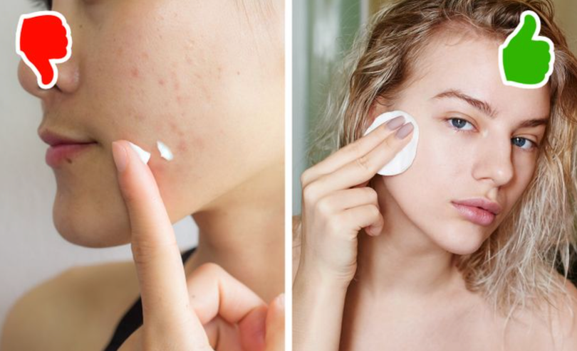 Bôi kem đánh răng lên da có thể gây kích ứng (Ảnh: BrightSide) Bôi kem đánh răng lên da có thể gây kích ứng (Ảnh: BrightSide)