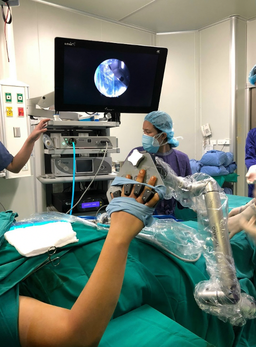 Các bác sĩ khoa Phẫu thuật Chi trên và Y học thể thao, Bệnh viện Hữu nghị Việt Đức đang phẫu thuật cho bệnh nhân T (Ảnh - BVCC)