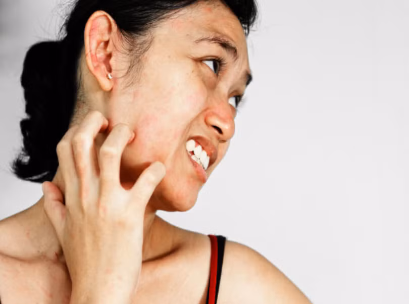 Tẩy da chết không đúng cách có thể khiến da bị tổn thương (Ảnh: Boldsky) 