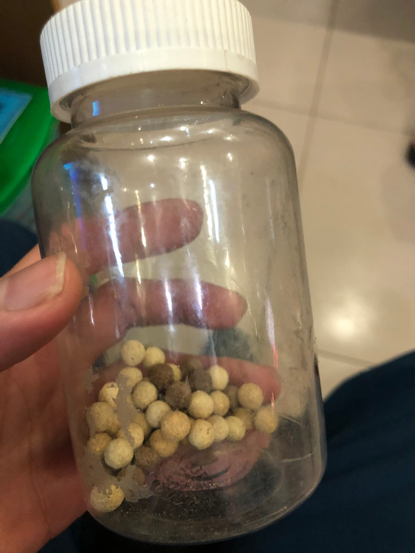 Viên thuốc nam trị tiểu đường khiến ông P. phải lọc máu thải độc (Ảnh: BVCC)