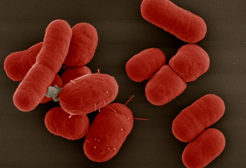 Một siêu vi khuẩn đa kháng thuốc (Ảnh minh hoạ)