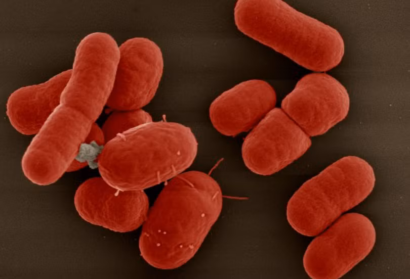 Một siêu vi khuẩn đa kháng thuốc (Ảnh minh hoạ) Một siêu vi khuẩn đa kháng thuốc (Ảnh minh hoạ)