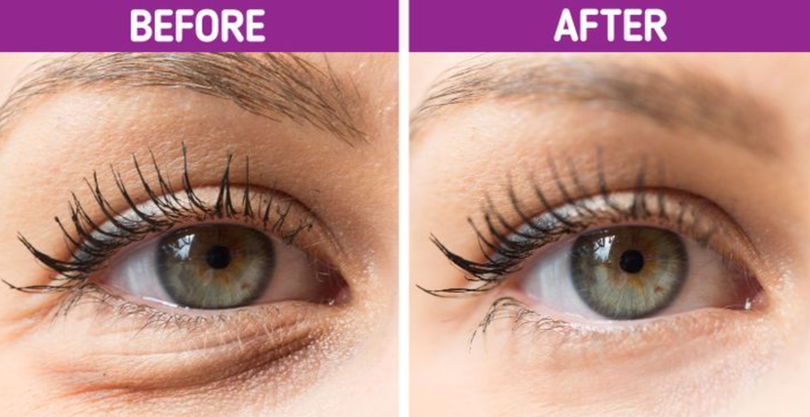 Ngủ đủ giấc sẽ giúp bạn loại bỏ quầng thâm và nếp nhăn (Ảnh: Brightside) Ngủ đủ giấc sẽ giúp bạn loại bỏ quầng thâm và nếp nhăn (Ảnh: Brightside)