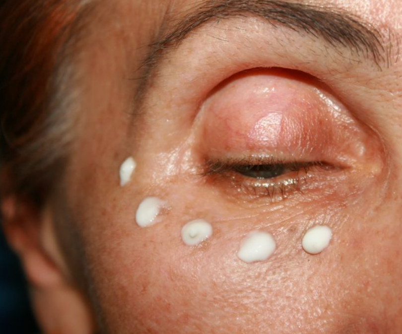 Kem dưỡng ẩm là vũ khí lợi hại đánh bay quầng thâm (Ảnh: Brightside) Kem dưỡng ẩm là vũ khí lợi hại đánh bay quầng thâm (Ảnh: Brightside)