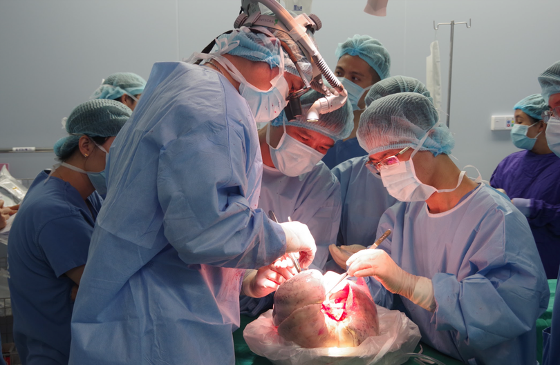 Các bác sĩ ghép phổi cho bệnh nhân bị xơ phổi nguyên phát (Ảnh: BVCC) Các bác sĩ ghép phổi cho bệnh nhân bị xơ phổi nguyên phát (Ảnh: BVCC)