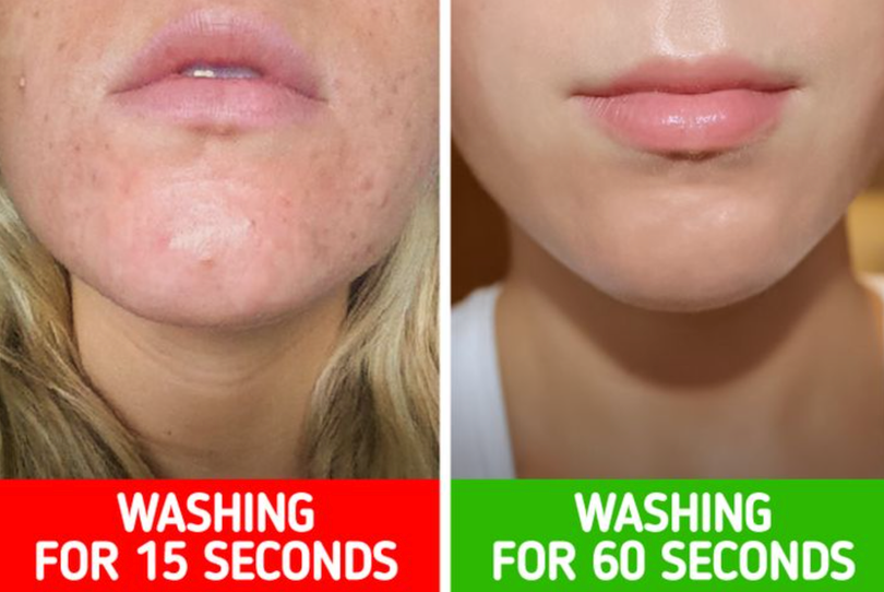 Rửa mặt trong thời gian ngắn làm tích tụ vi khuẩn và gây mụn (Ảnh: Brightside)