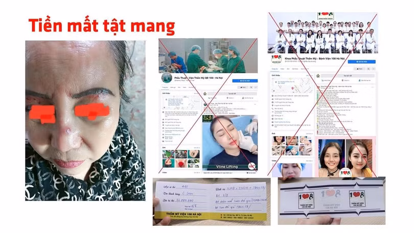 Trang facebook mạo danh Bệnh viện Trung ương Quân đội 108 khiến người dân "tiền mất, tật mang" (Ảnh - BVCC) 