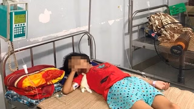 Bé gái bị viêm phúc mạc, tiên lượng xa có thể hẹp dạ dày môn vị, không thể ăn uống bằng đường miệng sau khi uống nhầm axit rửa ắc quy. (Ảnh: Bệnh viện Nhi Trung ương) 