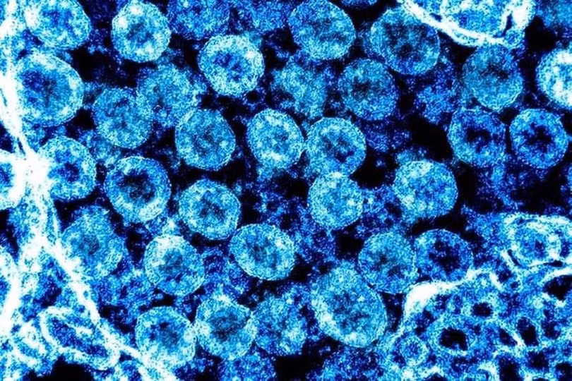 Virus SARS-CoV-2 (Ảnh: Viện Dị ứng và Bệnh truyền nhiễm Quốc gia Mỹ)