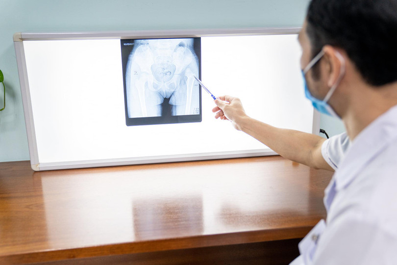 Bác sĩ xem phim chụp X-quang của trẻ (Ảnh - BVCC)
