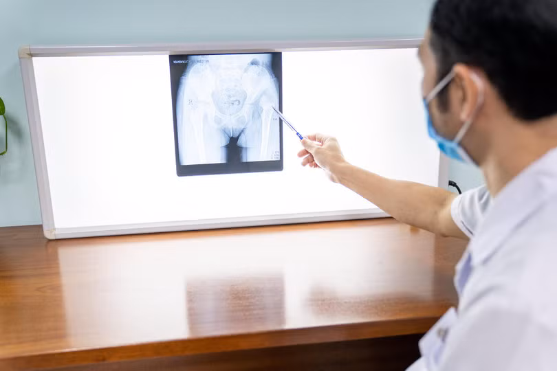 Bác sĩ xem phim chụp X-quang của trẻ (Ảnh - BVCC) Bác sĩ xem phim chụp X-quang của trẻ (Ảnh - BVCC)