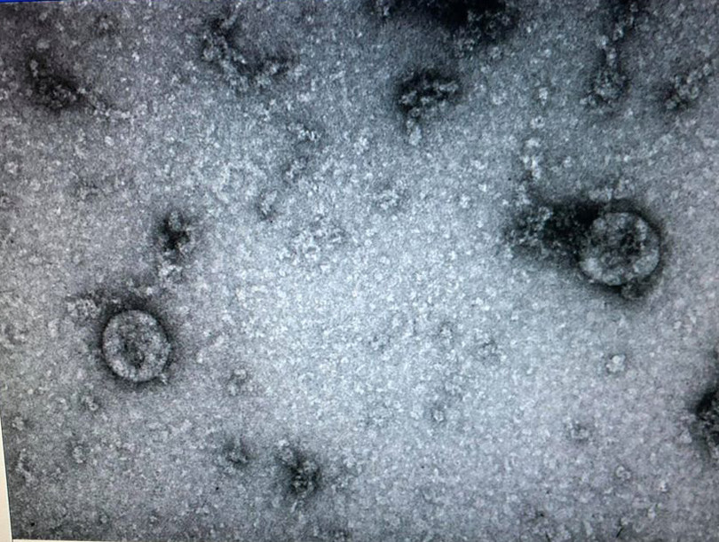 Virus Corona mới đã được nuôi cấy và phân lập thành công. Ảnh: Viện vệ sinh dịch tễ Trung ương 