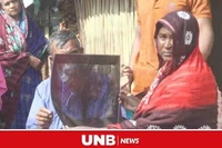 Người phụ nữ phát hiện chiếc kéo nằm trong bụng suốt 20 năm