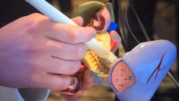 'Bút ung thư' phát hiện ra bệnh ung thư trong chỉ 20 giây - Ảnh 1