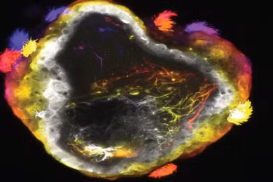 Các robot thần kinh (Neurobots) sở hữu một lớp bề mặt gồm các tế bào chuyên biệt và một hệ thần kinh điều khiển chuyển động. Ảnh: IE