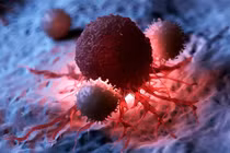 Tấn công tế bào ung thư. Ảnh minh họa