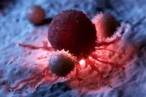 Tấn công tế bào ung thư. Ảnh minh họa