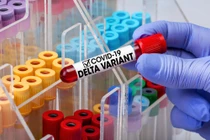 Giới khoa học Nhật Bản tin rằng biến chủng Delta đang tự đi đến chỗ diệt vong một cách tự nhiên (Ảnh: Shutterstock)