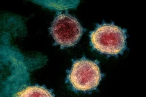 Biến chủng B.1.1.529 khiến WHO và một số nước đưa ra phản ứng (Ảnh: Handout)