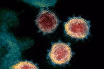 Biến chủng B.1.1.529 khiến WHO và một số nước đưa ra phản ứng (Ảnh: Handout)