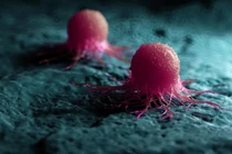 Các nhà nghiên cứu đã xác định được hai enzyme protein đóng vai trò quan trọng trong việc giúp tế bào ung thư tuyến tiền liệt phát triển và kháng lại liệu pháp điều trị. Ảnh: Shutterstock