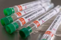 Có nhiều giả thuyết liên quan tới đậu mùa khỉ (Ảnh: Japan Times)