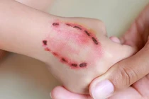 Động vật có vú, máu nóng (chó, mèo, dơi,...) cắn dễ gây ra bệnh dại. Ảnh: Wikihow