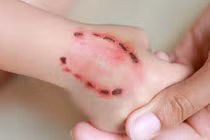 Động vật có vú, máu nóng (chó, mèo, dơi,...) cắn dễ gây ra bệnh dại. Ảnh: Wikihow