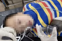 Bệnh nhi người Trung Quốc được cấp cứu tại Bệnh viện đa khoa Hải Dương tối 26/1. Ảnh: Báo Hải Dương