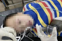 Bệnh nhi người Trung Quốc được cấp cứu tại Bệnh viện đa khoa Hải Dương tối 26/1. Ảnh: Báo Hải Dương