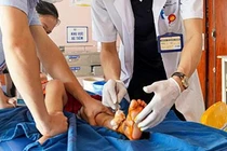 Các bác sĩ đang chăm sóc vết thương do cửa tự động gây ra đối với trẻ (ảnh BVCC)