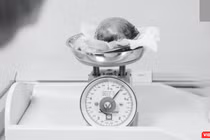 Khối u lấy ra từ tử cung của bệnh nhân H.