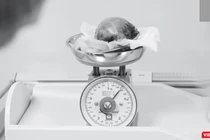 Khối u lấy ra từ tử cung của bệnh nhân H.