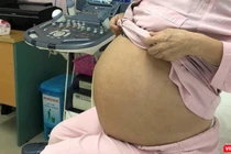 Bệnh nhân M. trước khi phẫu thuật