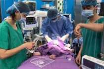 Các bác sĩ Trung tâm Tim mạch của Bệnh viện Sản Nhi Quảng Ninh đang thực hiện phẫu thuật.