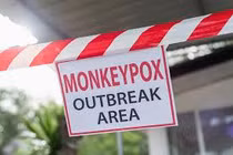 WHO tuyên bố đợt bùng phát dịch đậu mùa khỉ là tình trạng khẩn cấp y tế toàn cầu (Ảnh: SciTechDaily)