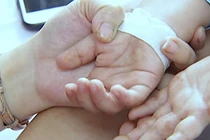 Trẻ mắc bệnh tay chân miệng có xu hướng gia tăng (Ảnh - Cục Y tế Dự phòng, BYT) 