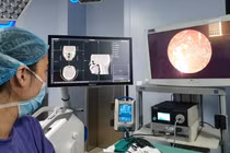 Các bác sĩ của Bệnh viện Trung ương Quân đội 108 phẫu thuật loại bỏ khối u cho bệnh nhân (Ảnh - BVCC) 