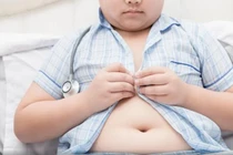 Ngày càng nhiều trẻ bị béo phì vì chế độ dinh dưỡng không hợp lý (Ảnh minh hoạ) 