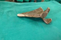 Bả vai nhân tạo làm bằng vật liệu sinh học và công nghệ in 3D (Ảnh: PGS. TS. Trần Trung Dũng)