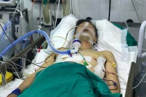 Bệnh nhân được điều trị tại Bệnh viện Hữu nghị Việt Đức với nhiều vết thương phức tạp (Ảnh: BVCC) 