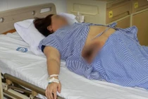 Bệnh nhân đái tháo đường bị loét bụng sau khi bôi thuốc của thầy lang (Ảnh: BVCC) 