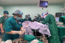 Bác sĩ phẫu thuật tách rời cặp song sinh dính liền (Ảnh: Bệnh viện Nhi đồng Thành phố - TP. Hồ Chí Minh) 