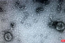 Virus SARS-CoV-2 (Ảnh - Minh Thuý) 