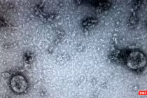 Virus SARS-CoV-2 (Ảnh - Minh Thuý) 