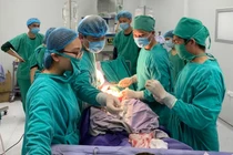 Các bác sĩ phẫu thuật cho sản phụ nguy kịch ở Trung tâm Y tế huyện Cô Tô (Ảnh - BVCC) 