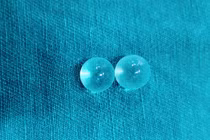 2 viên bi được cấy vào thân dương vật sát quy đầu của người bệnh. Ảnh: BVCC